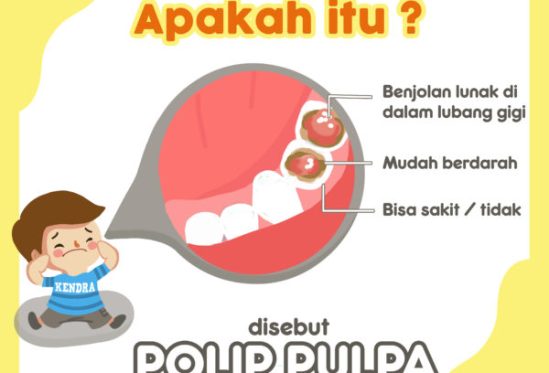 Daging Dalam Lubang Gigi, Apakah Berbahaya?