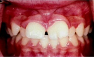 Gigi anak terlihat aneh 8