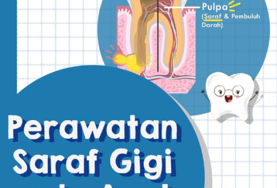 Perawatan Saraf Gigi Pada Anak