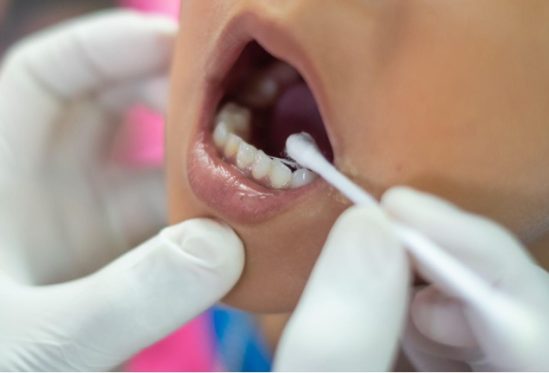 Sudahkah Anak Mendapat Imunisasi Gigi?